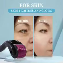540 Titanium Microneedling Derma Roller for Face, Hair & Beard Growth